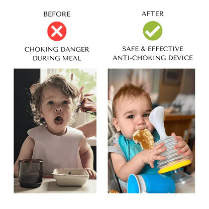 NoChock™ANTI-CHOKING DEVICE